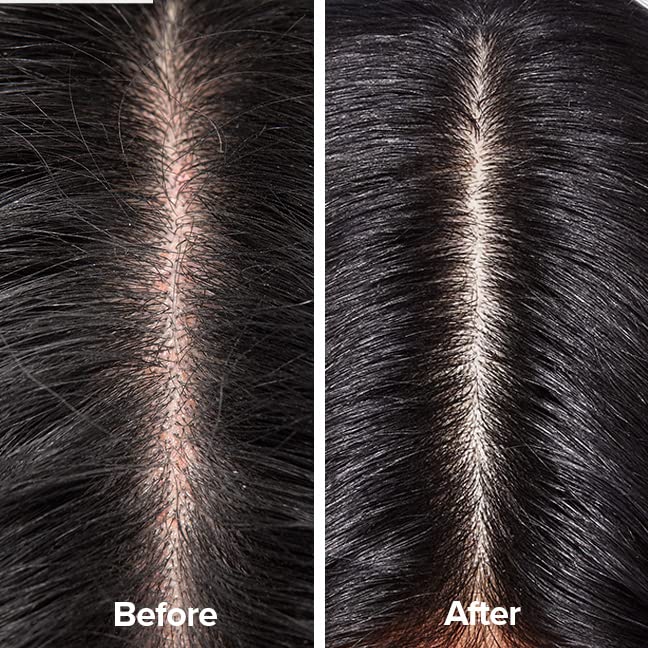 Scalp Therapy Shampoo G585