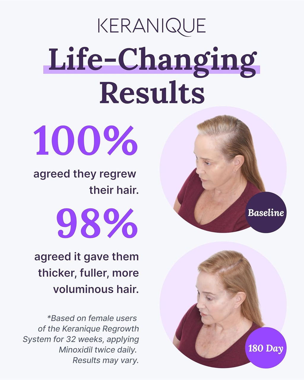 2% Minoxidil Hair Regrowth Tonic for Women M4820